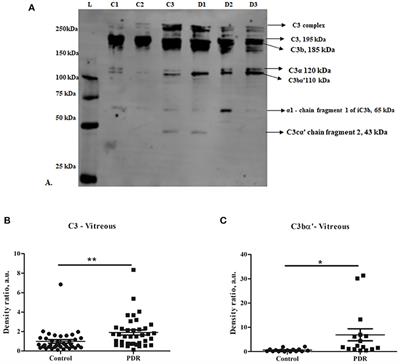 A Systematic Investigation on Complement Pathway Activation in Diabetic Retinopathy